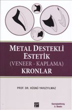 Metal Destekli Estetik (Veneer-Kaplama)Kronlar - Gazi Kitabevi Kitap