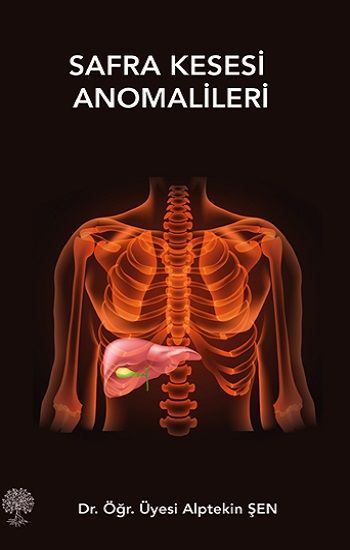 Safra Kesesi Anomalileri - Platanus Publishing Kitap
