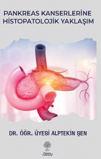 Pankreas Kanserlerine Histopatolojik Yaklaşım - Platanus Publishing Kitap