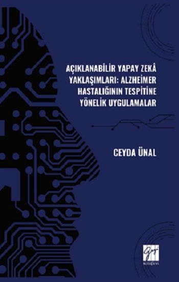Açıklanabilir Yapay Zekâ Yaklaşımları: Alzheimer Hastalığının Tespitine Yönelik Uygulamalar - Gazi Kitabevi Kitap
