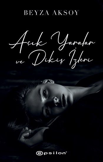 Açık Yaralar ve Dikiş İzleri - Epsilon Yayınları Kitap